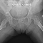 Case 11 Khaled Amir
