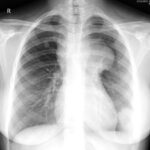 Case 14