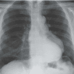 Case 15