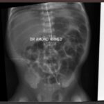 Case 7.1