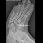 Case 9.2