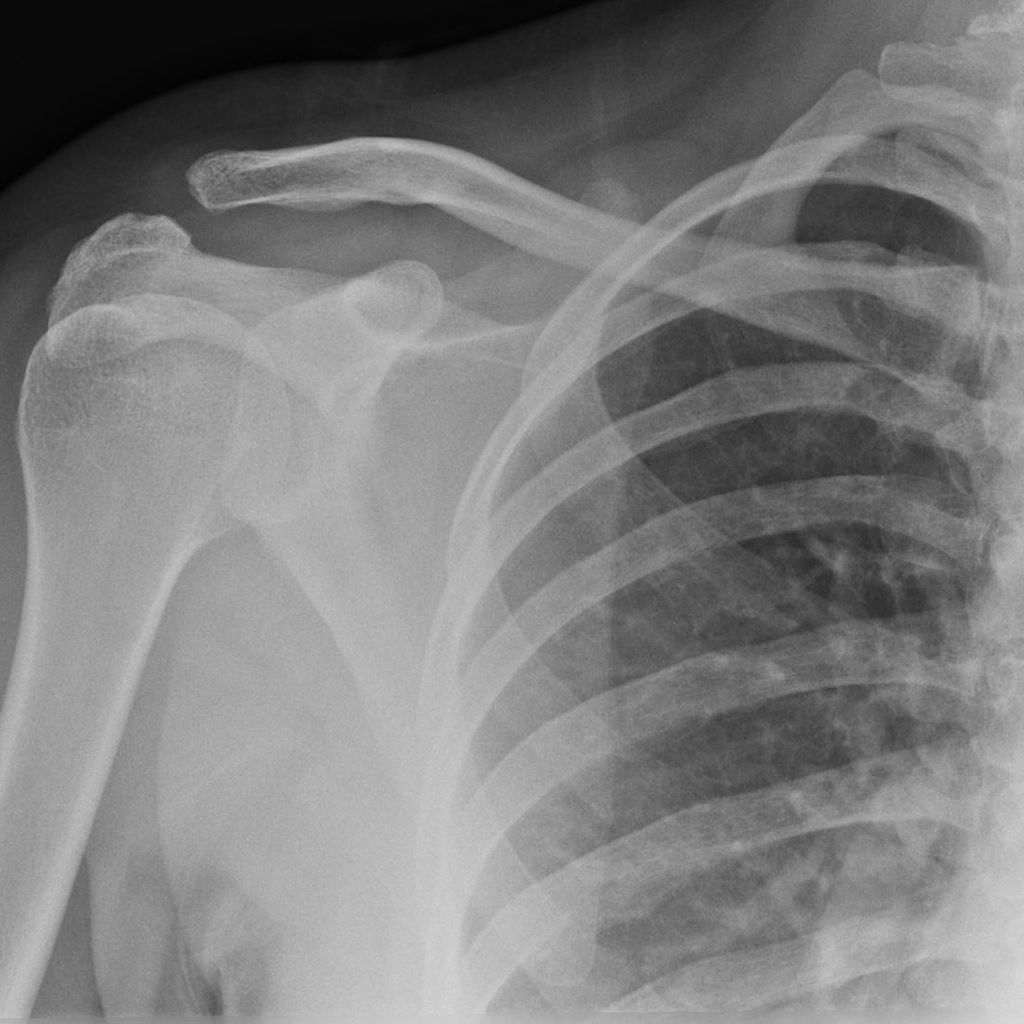 Short Cases Vs Oral Cases