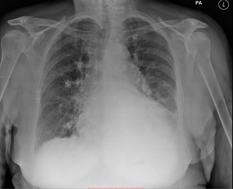 Ct Oral Cases In Frcr 2b