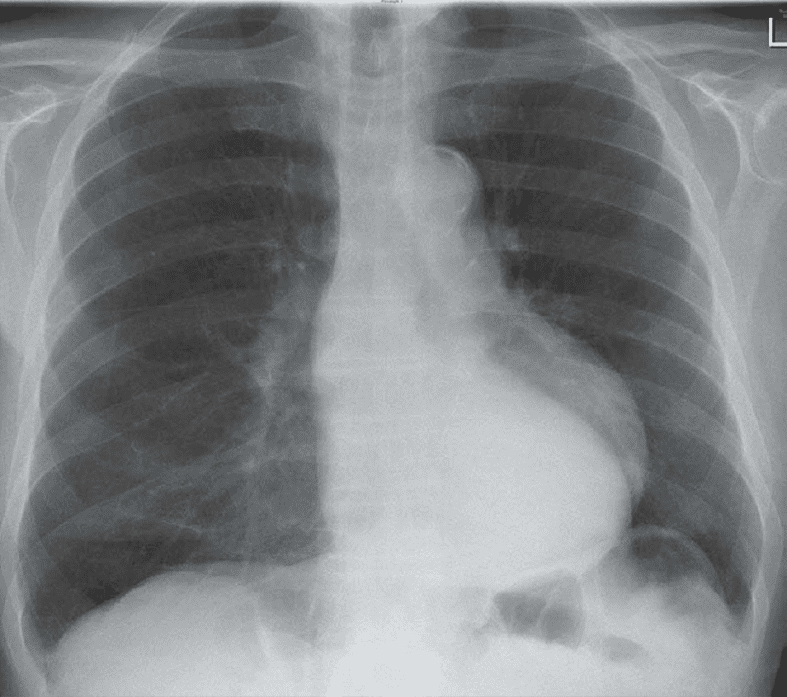 Plain Film Oral Cases In Frcr 2b