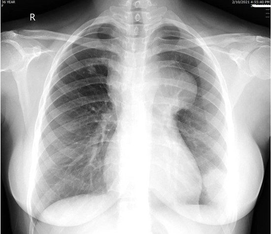 How To Justify Differential Diagnoses In Frcr Oral Exams