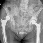 Case 6
