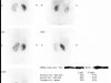 24 Dmsa Left Kidney